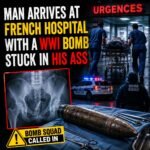 Man Arrives at French Hospital With a WWI Bomb Stuck in His Ass